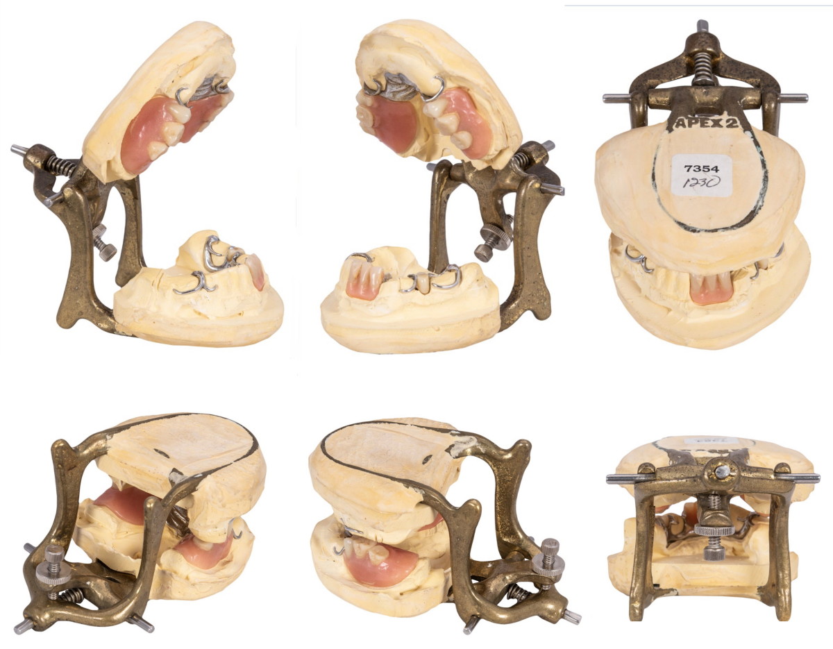 Exhibit of purported Ty Cobb dentures sold by SCP Auctions in September 2022.